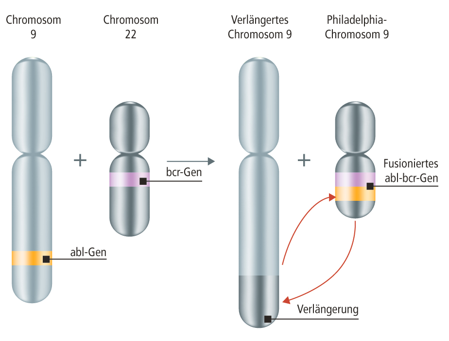 Wie entsteht das Philadelphia-Chromosom?